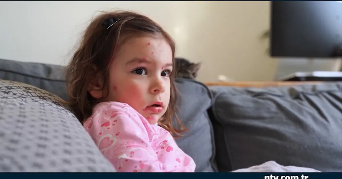 Unutulan hastalık geri mi dönüyor? İstanbul’da vaka sayılarında artış