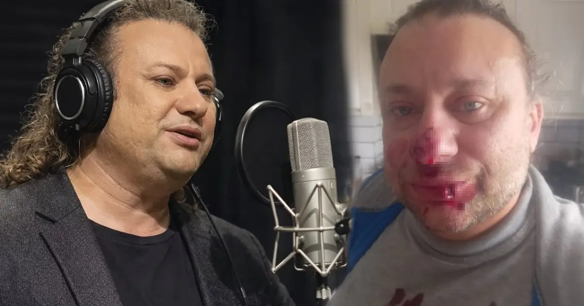 Ünlü sanatçı et yiyen bakteriyle savaşıyor