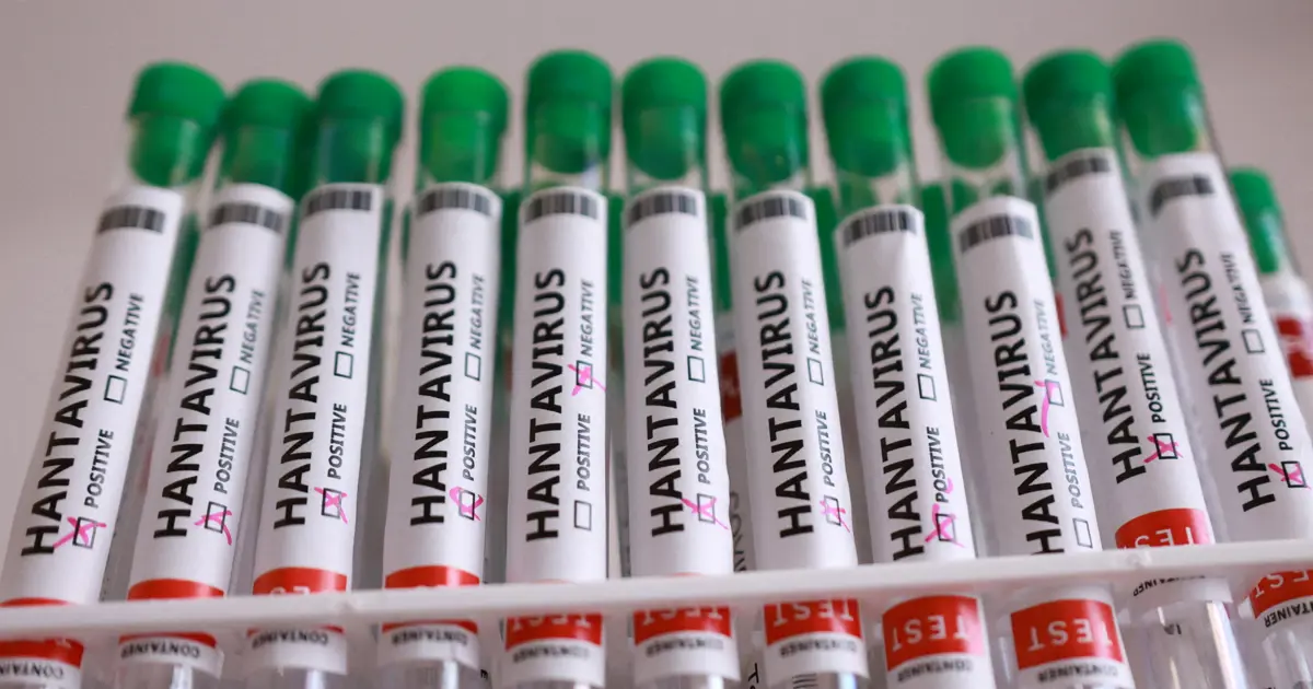 Fransa Sağlık Bakanlığı: Hantavirüslü yolcunun durumu kötüleşiyor