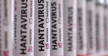 Hantavirüste hangi meslekler daha fazla risk altında?