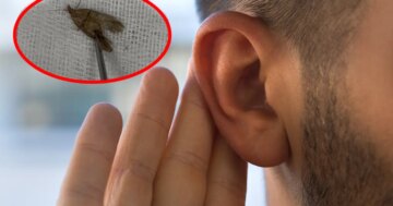 40 yaşındaki adamın kulağından çıktı. Hareketliydi, doğaya bırakıldı